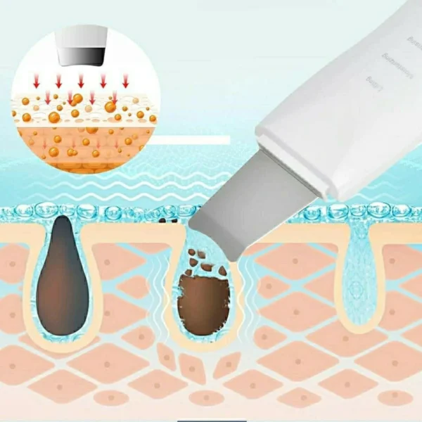 ESPATULA FACIAL ULTRASONICA LIMPIEZA PEELING - Imagen 4