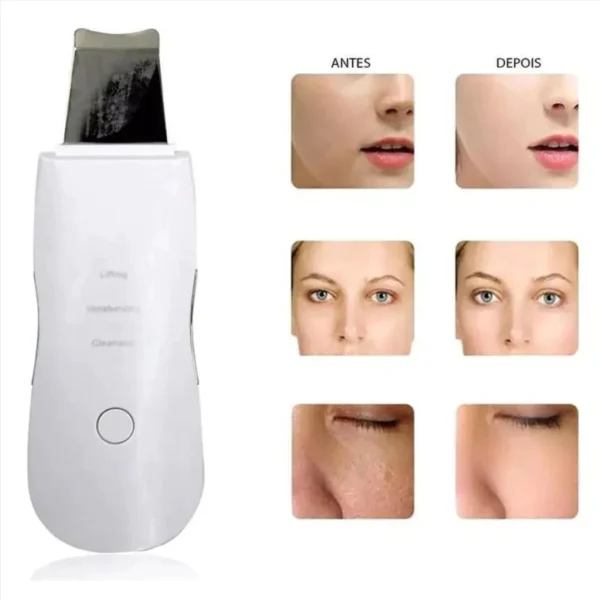 ESPATULA FACIAL ULTRASONICA LIMPIEZA PEELING - Imagen 6